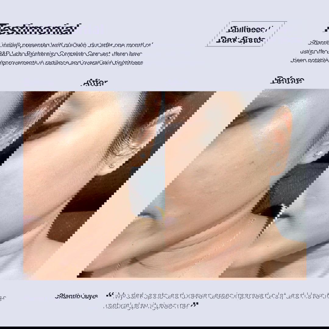 RENEW Brightening Graphene Mask