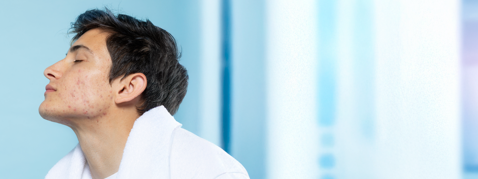 Acne Isn’t the Enemy — A Damaged Skin Barrier Is