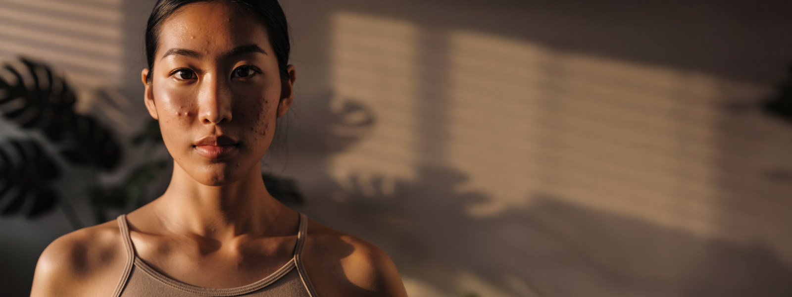 Acne Treatment: Free Checklist