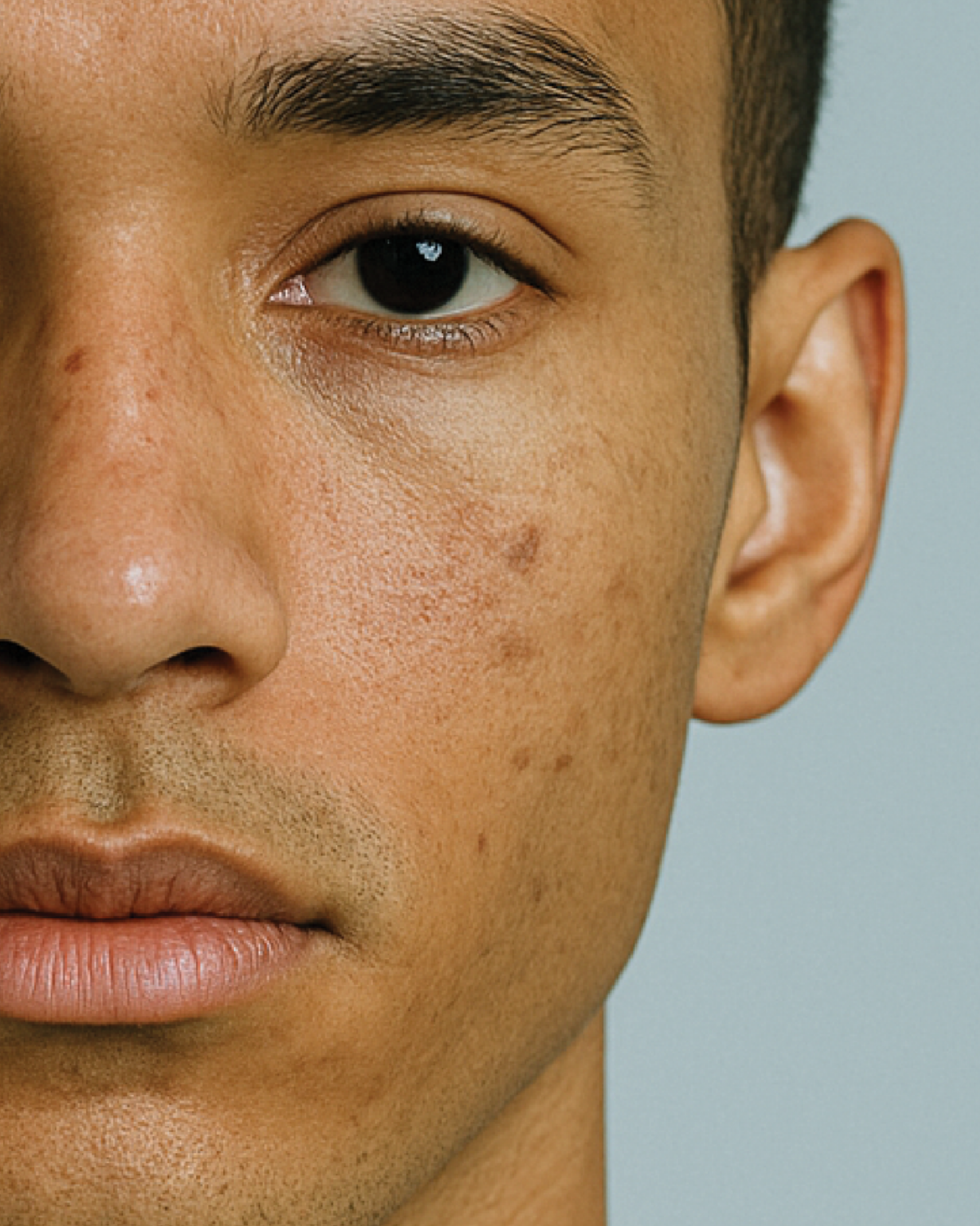 Dullness / Dark Spots